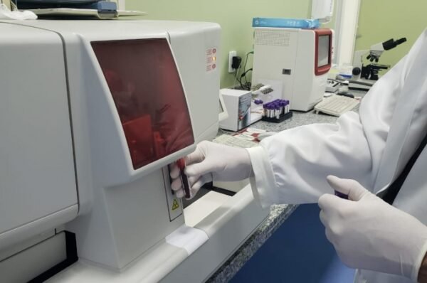 Laboratório de exames clínicos da UPA de Valinhos já atendeu mais de 900 pessoas
