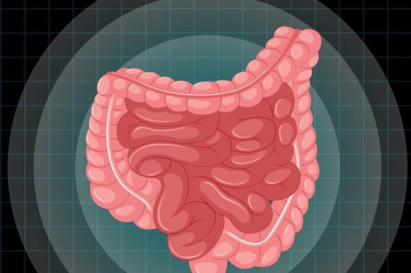 Câncer de intestino: a detecção precoce é fundamental para o tratamento e a cura