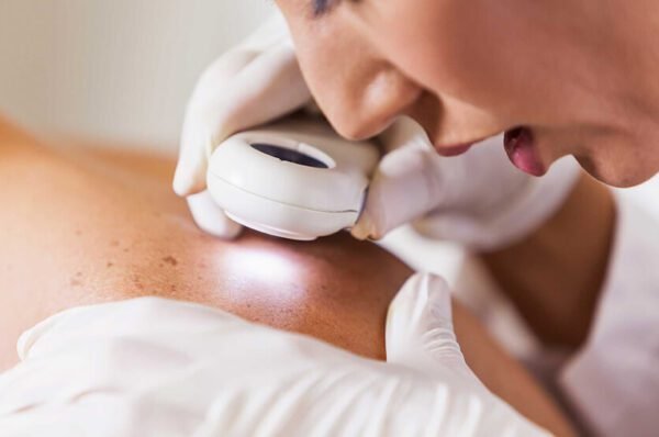 <strong>Dermatologia é a especialidade com maior demora na Saúde Pública em Valinhos</strong>